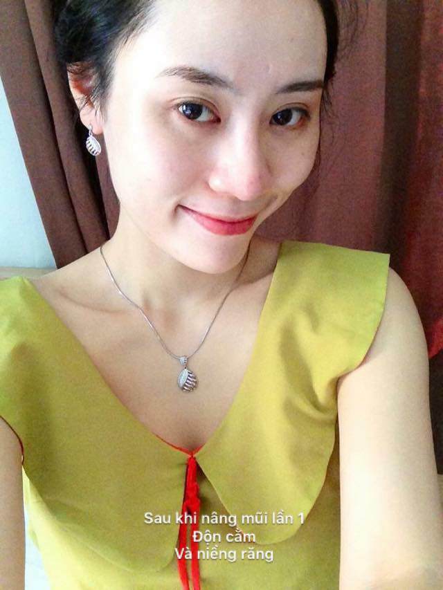 my nhan ha thanh tiet lo cau chuyen 15 nam phau thuat tham my de xung doi voi ong xa - 4